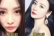 颜值革命：女星整容进化论，谁在定义美的游戏规则？